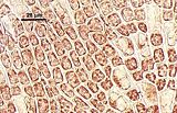 4 - Filamenti basali con tricociti intercalari ed abbondanti cellule di fusione
